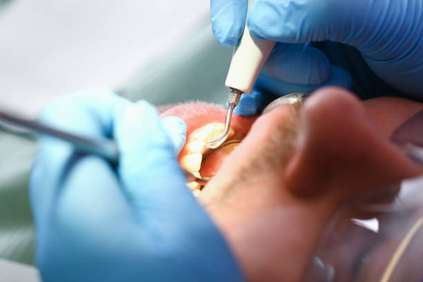 Best Emergency Wisdom Tooth Extraction in Leisure Village West, NJ