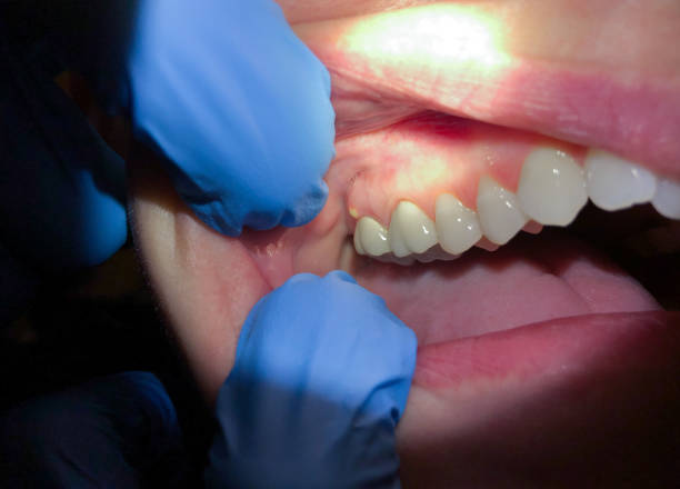 Best Broken or Chipped Tooth Repair in Leisure Village West, NJ